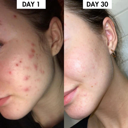 Lunoox™ Turmeric & Kojic Acid Soap Bar