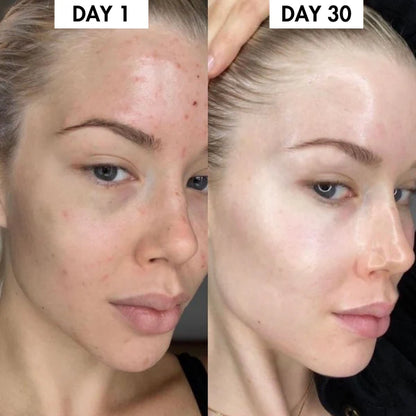 Lunoox™ Turmeric & Kojic Acid Soap Bar