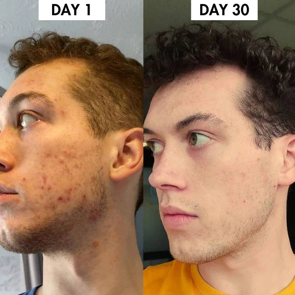 Lunoox™ Organic Silk Pillowcase (Buy 1 Get 1 Free)