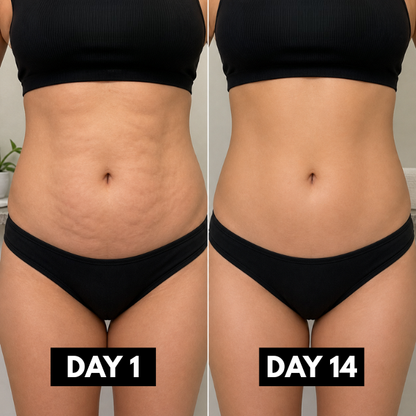 Lunoox™ Cryo Thermo Firming Gold Gel