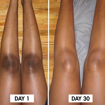 Lunoox™ Turmeric & Kojic Acid Soap Bar