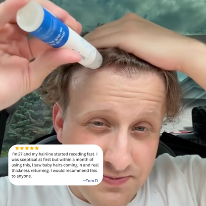 Lunoox™ Organic Hair Growth Serum